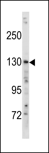 Rabbit Polyclonal Antibody to TSC1 (Center T417)
