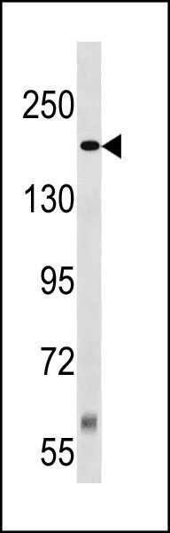 Rabbit Polyclonal Antibody to TSC2 (Center S1385/S1386)