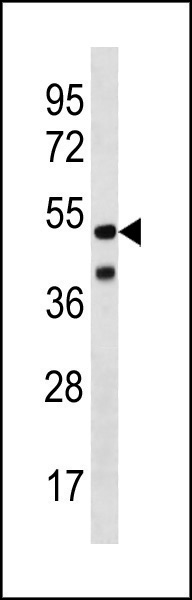 Rabbit Polyclonal Antibody to HHV14 UL38