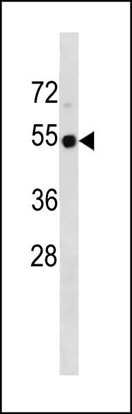 Rabbit Polyclonal Antibody to TP53