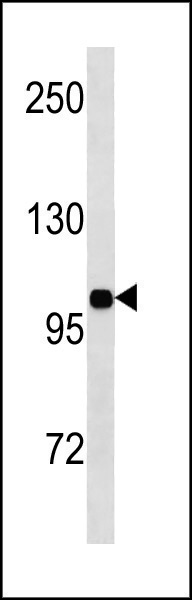 Rabbit Polyclonal Antibody to INSR (N-term)