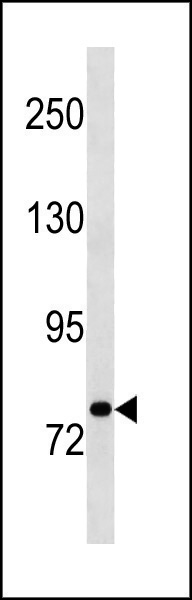 Rabbit Polyclonal Antibody to STAT3 (N-term)
