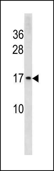 Rabbit Polyclonal Antibody to HIST1H3/2H3/3H3/H3F3 (N-term)
