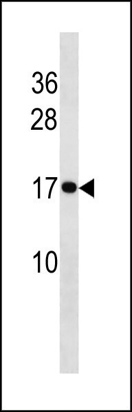 Rabbit Polyclonal Antibody to HIST1H3/2H3/3H3/H3F3
