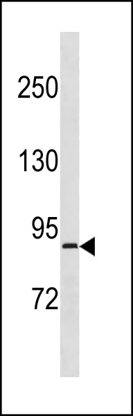 Rabbit Polyclonal Antibody to RPS6KA4