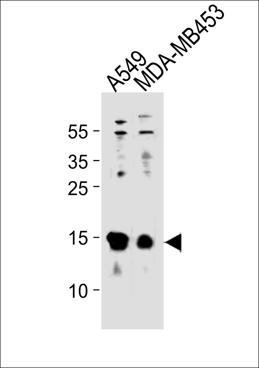 Rabbit Polyclonal Antibody to TXN