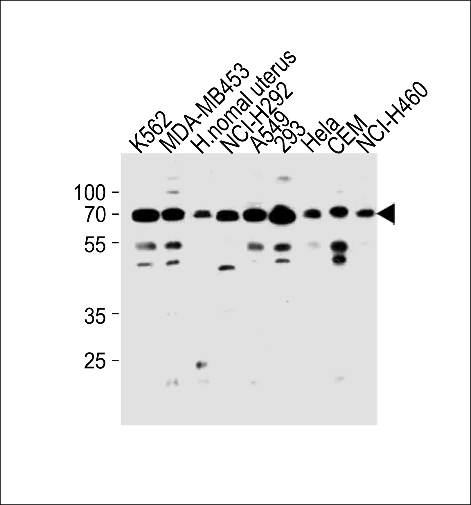 Rabbit Polyclonal Antibody to PARP3 (N-term)