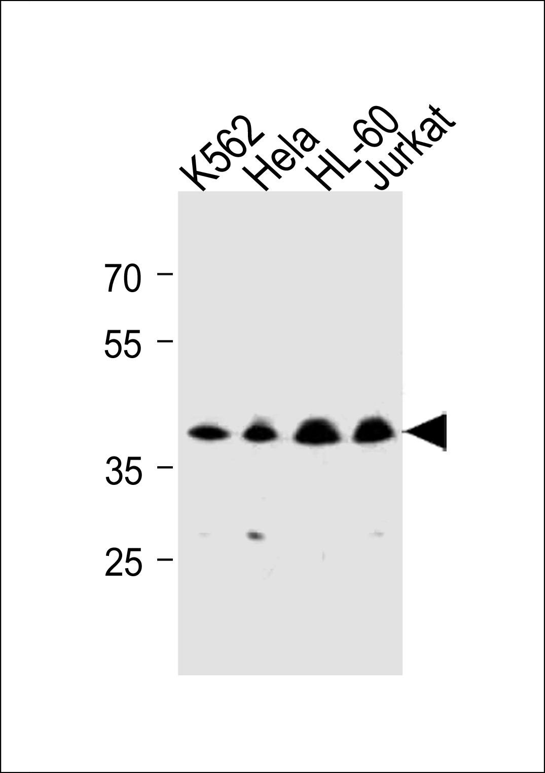 Rabbit Polyclonal Antibody to MECR