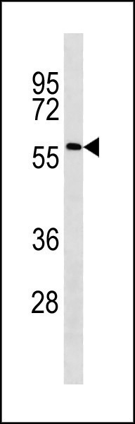 Rabbit Polyclonal Antibody to ACSF2