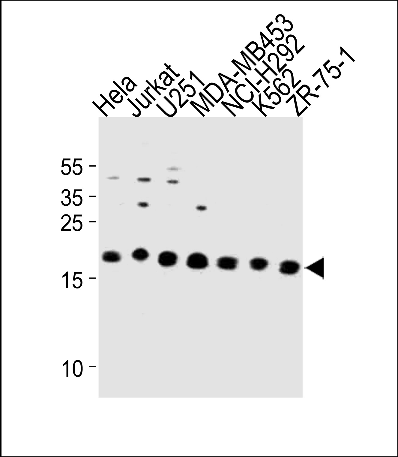 Rabbit Polyclonal Antibody to ICT1