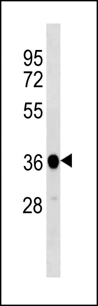Rabbit Polyclonal Antibody to XENLA ppp1cb