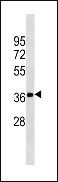 Mouse Monoclonal Antibody to FN3K (N-term)(Ascites)