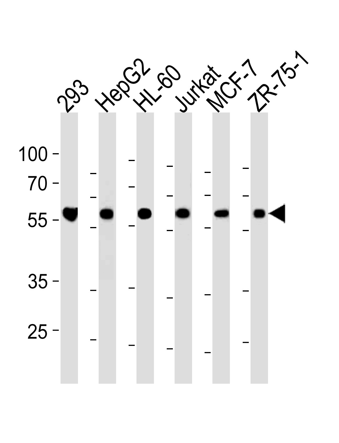 Rabbit Polyclonal Antibody to ZRSR2