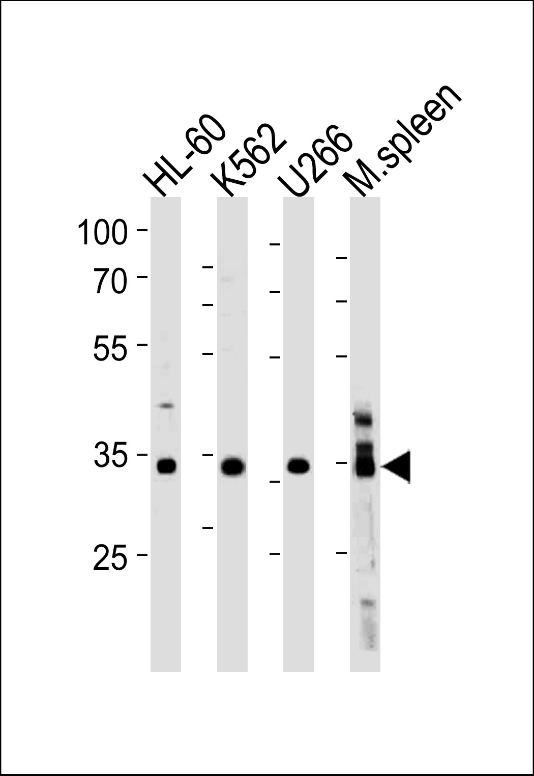 Rabbit Polyclonal Antibody to GFI1B