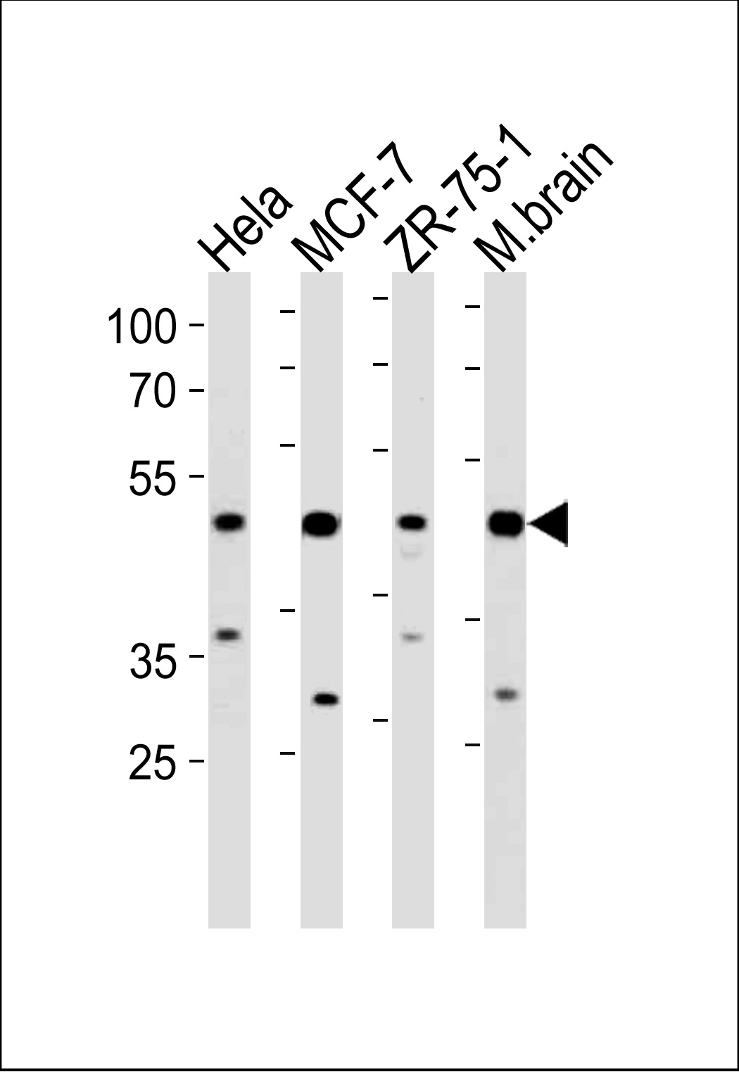 Rabbit Polyclonal Antibody to FBXO28