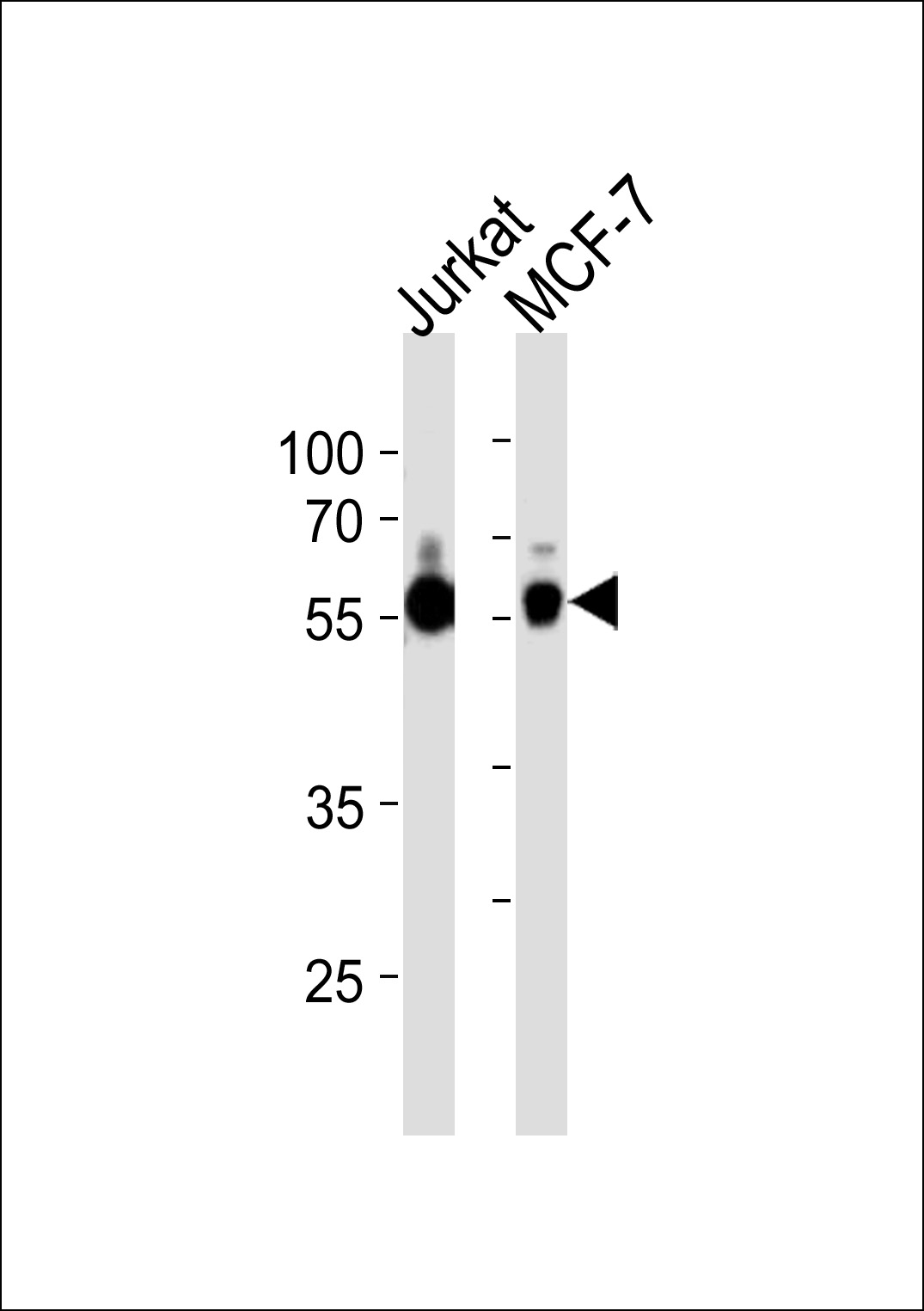 Rabbit Polyclonal Antibody to ZNF434