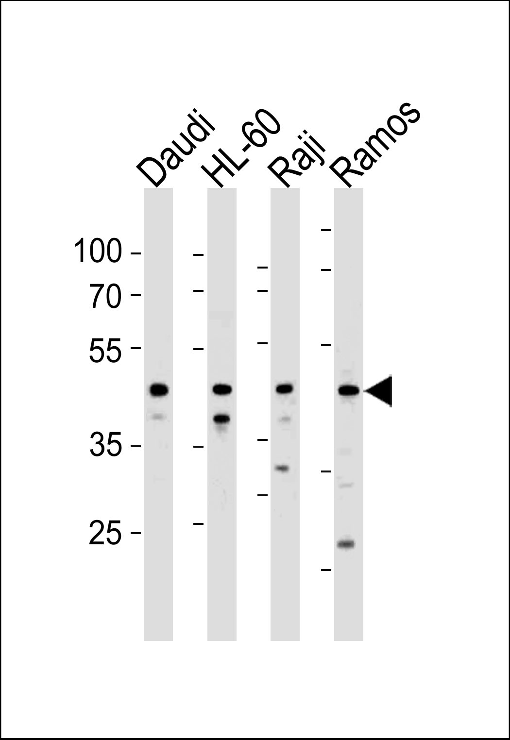 Rabbit Polyclonal Antibody to LILRA3