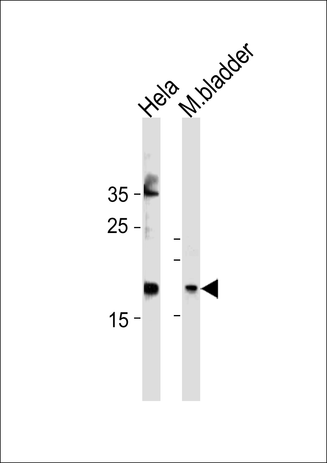 Rabbit Polyclonal Antibody to FAM159A