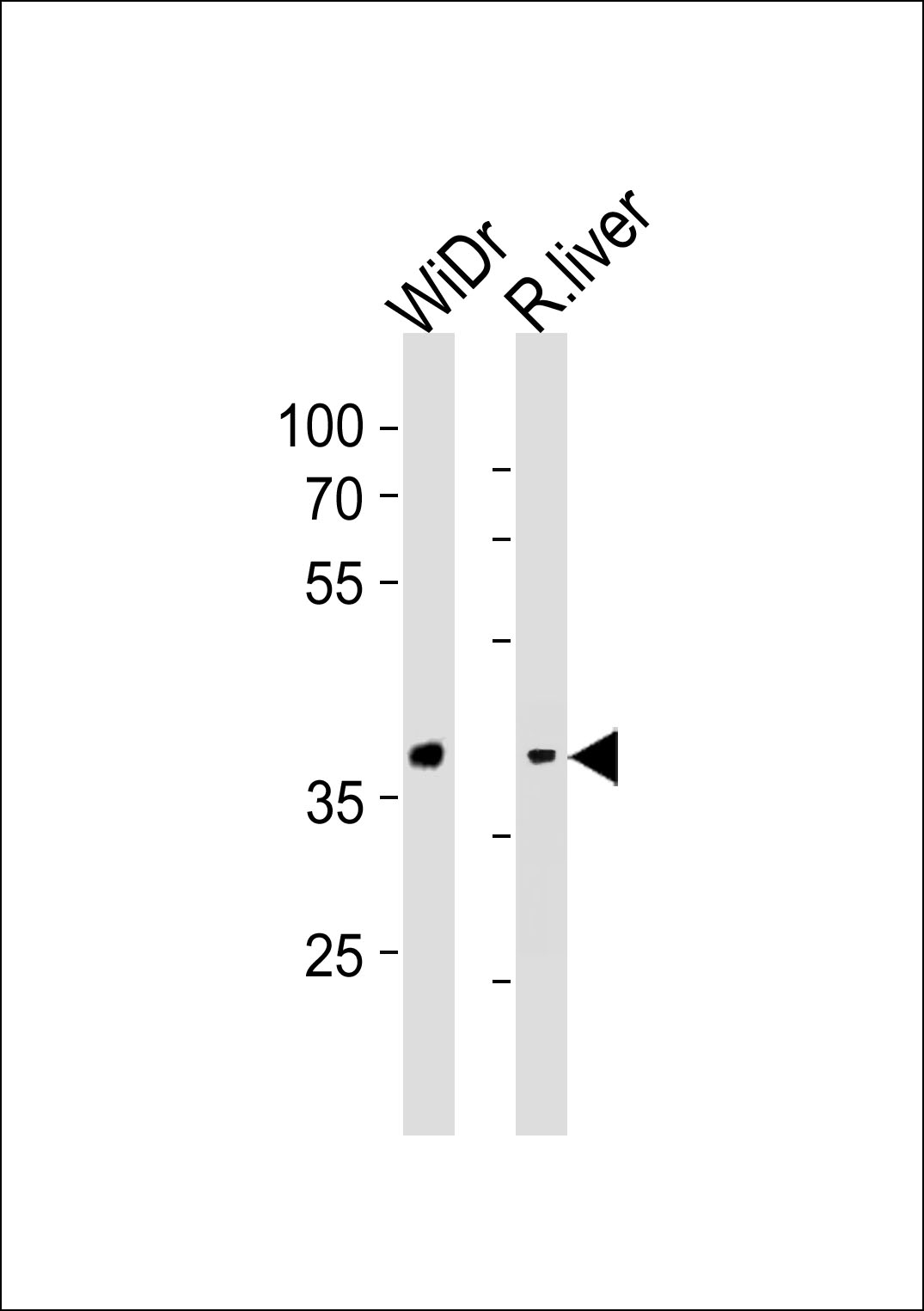 Rabbit Polyclonal Antibody to GPR4