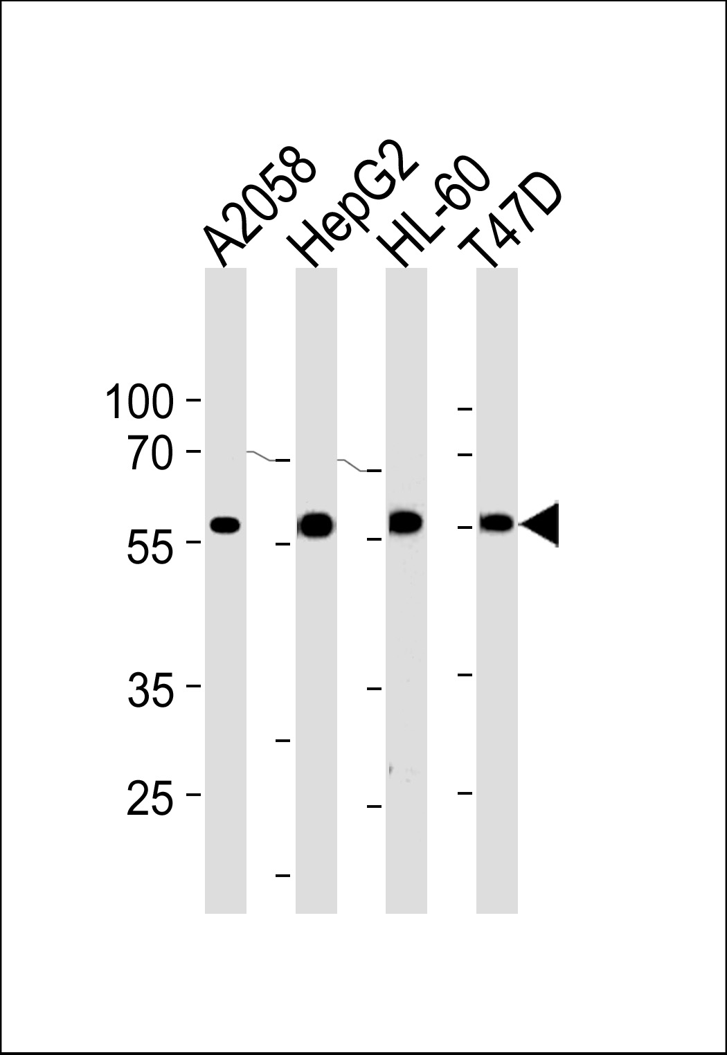 Rabbit Polyclonal Antibody to GRN
