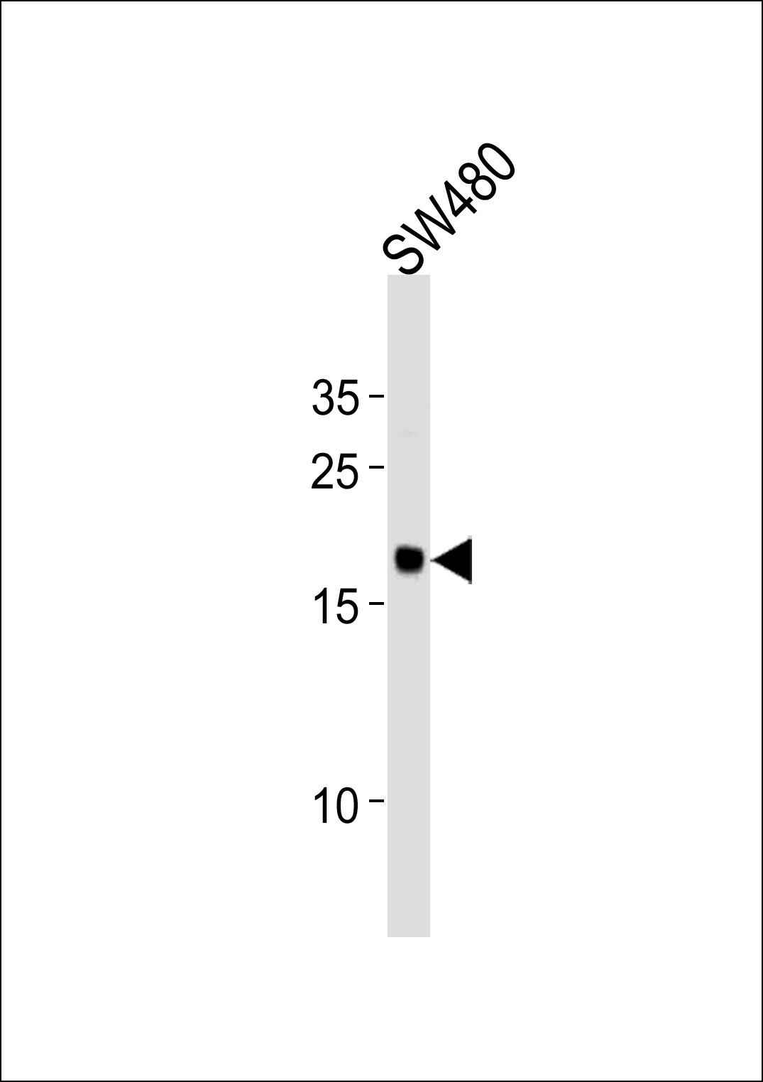 Rabbit Polyclonal Antibody to RPL29