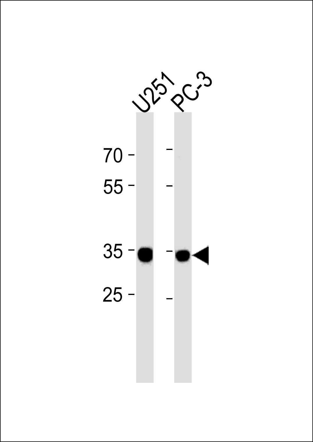 Rabbit Polyclonal Antibody to RPLP0P6 (N-term)