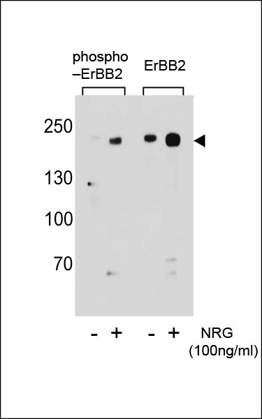 Rabbit Polyclonal Antibody to Phospho-ERBB2(S1151)