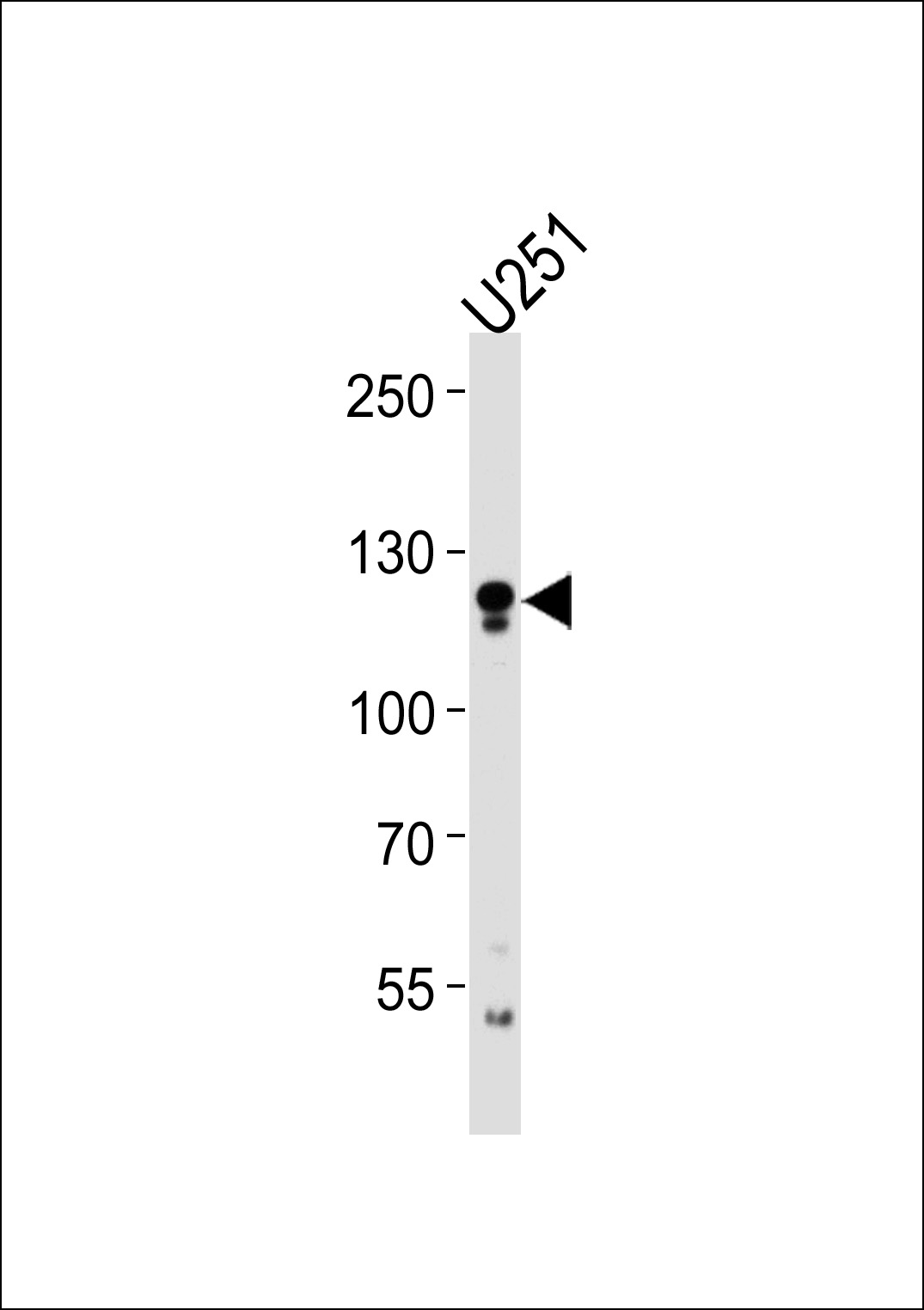 Rabbit Polyclonal Antibody to ECE2