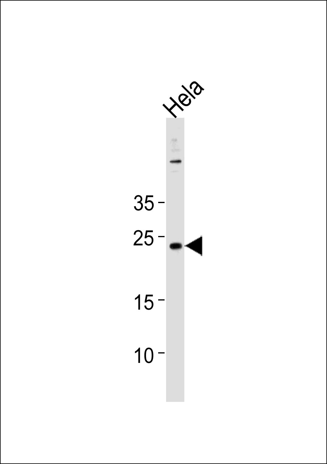 Rabbit Polyclonal Antibody to CNO