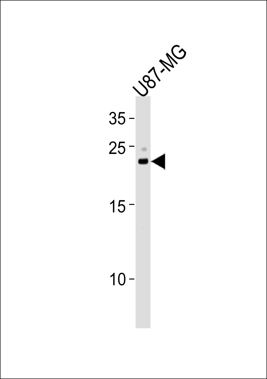 Rabbit Polyclonal Antibody to CNTF