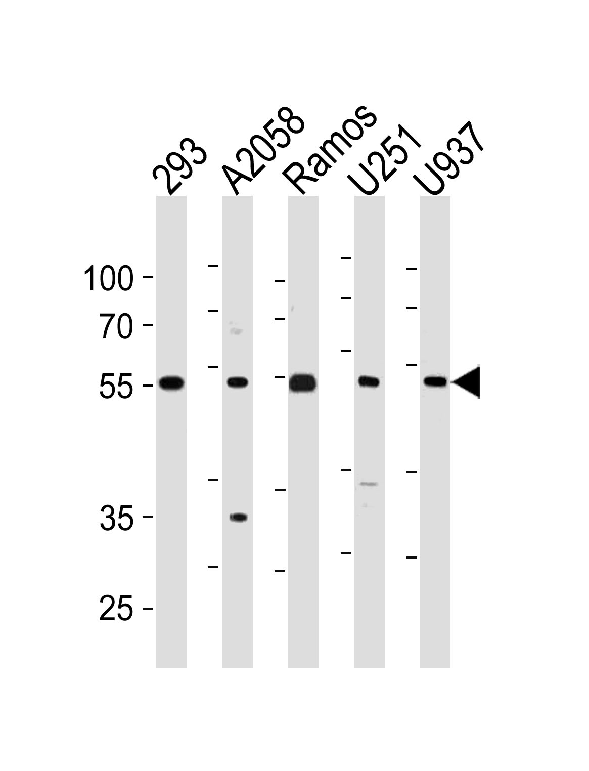 Rabbit Polyclonal Antibody to CDCA7L