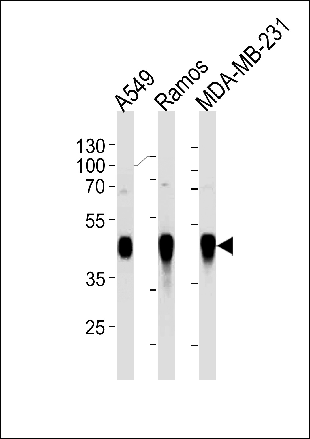 Mouse Monoclonal Antibody to HLA-G