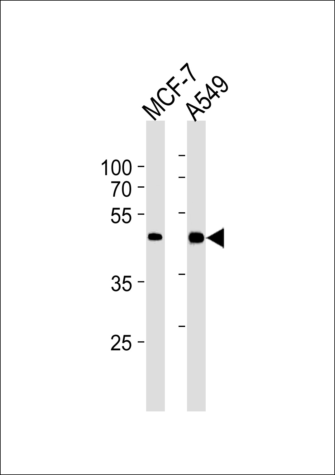 Mouse Monoclonal Antibody to CCRK (N-term)