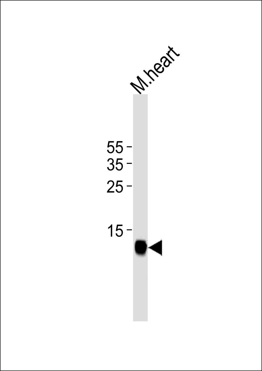Mouse Monoclonal Antibody to FAPB3(Ascites)