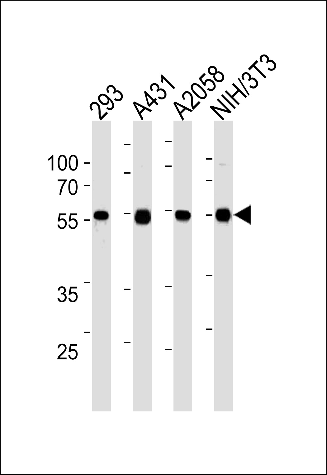 Mouse Monoclonal Antibody to TPIPb(Ascites)