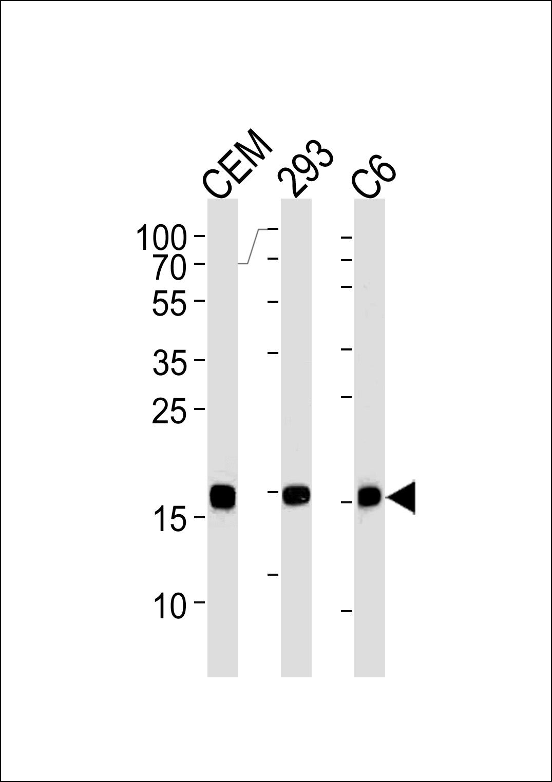 Mouse Monoclonal Antibody to SUMO2