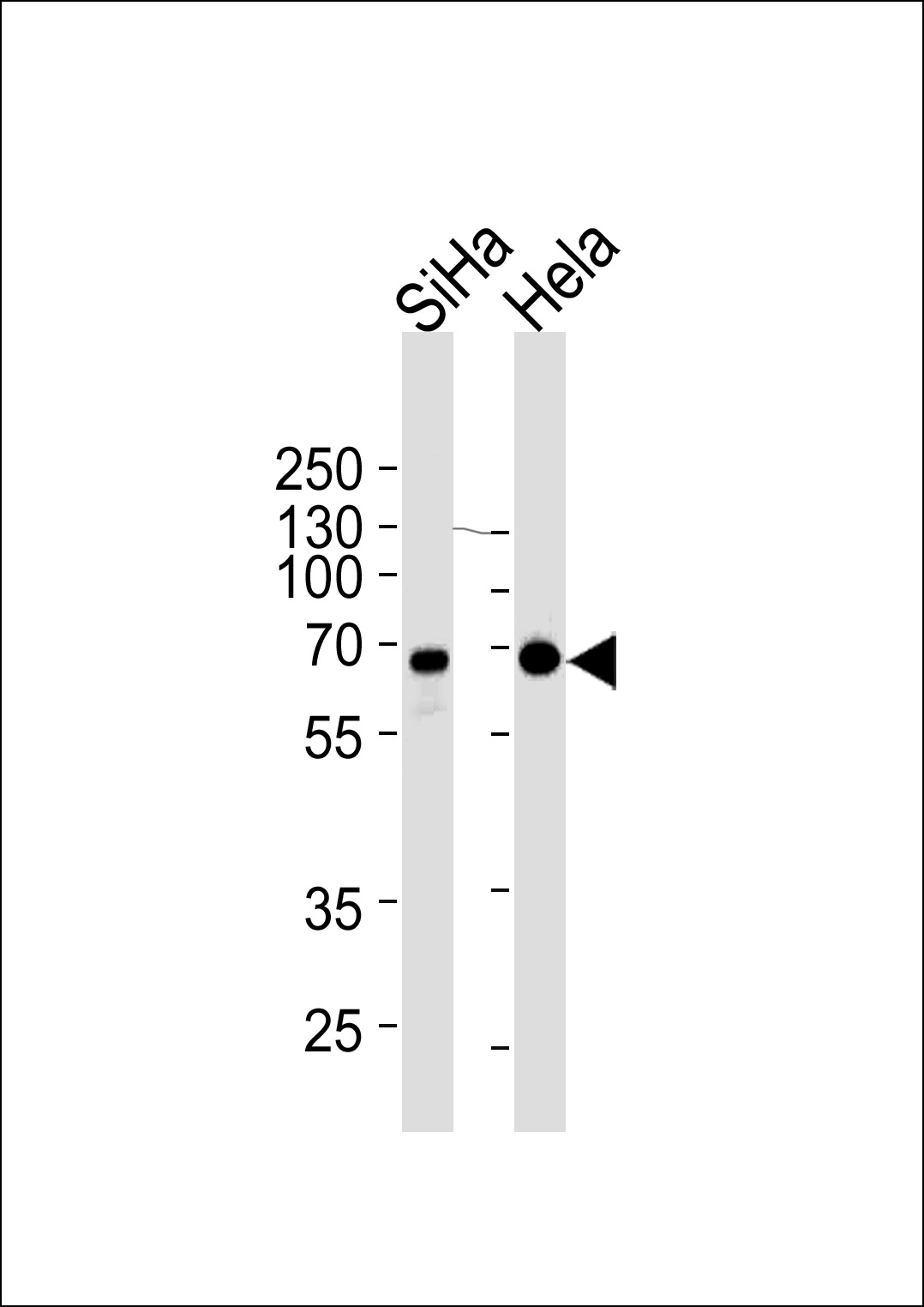 Mouse Monoclonal Antibody to NLK
