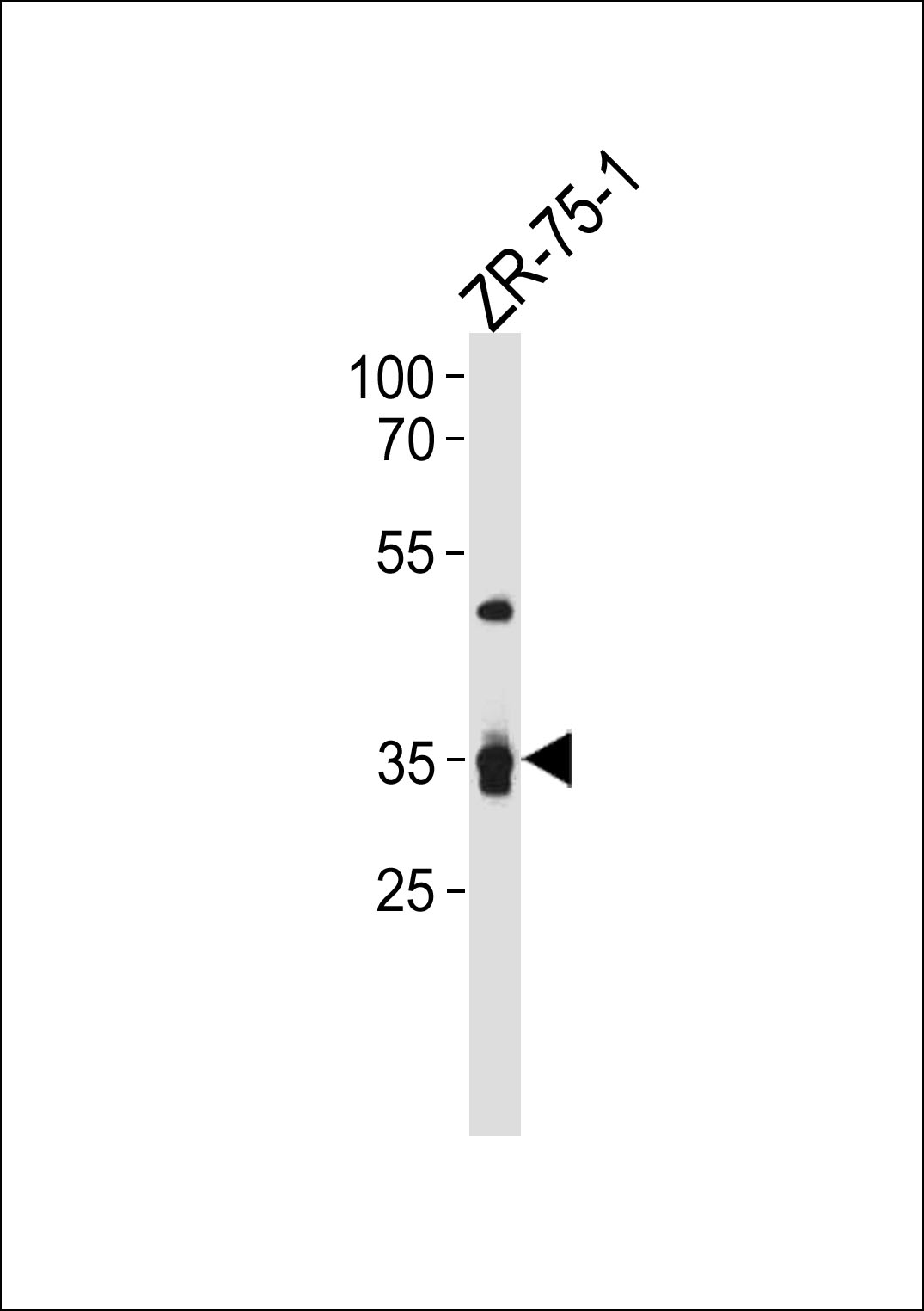 Rabbit Polyclonal Antibody to IL3RA