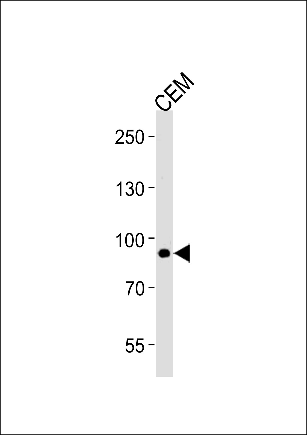 Rabbit Polyclonal Antibody to MATN2