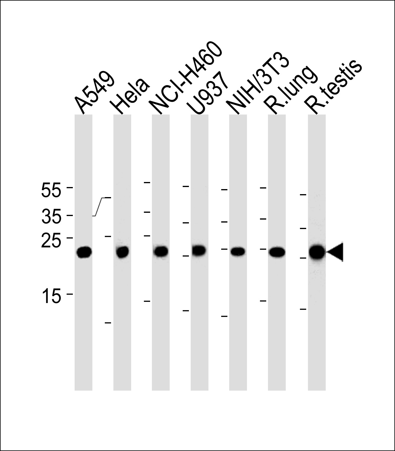Rabbit Polyclonal Antibody to R Cebpd