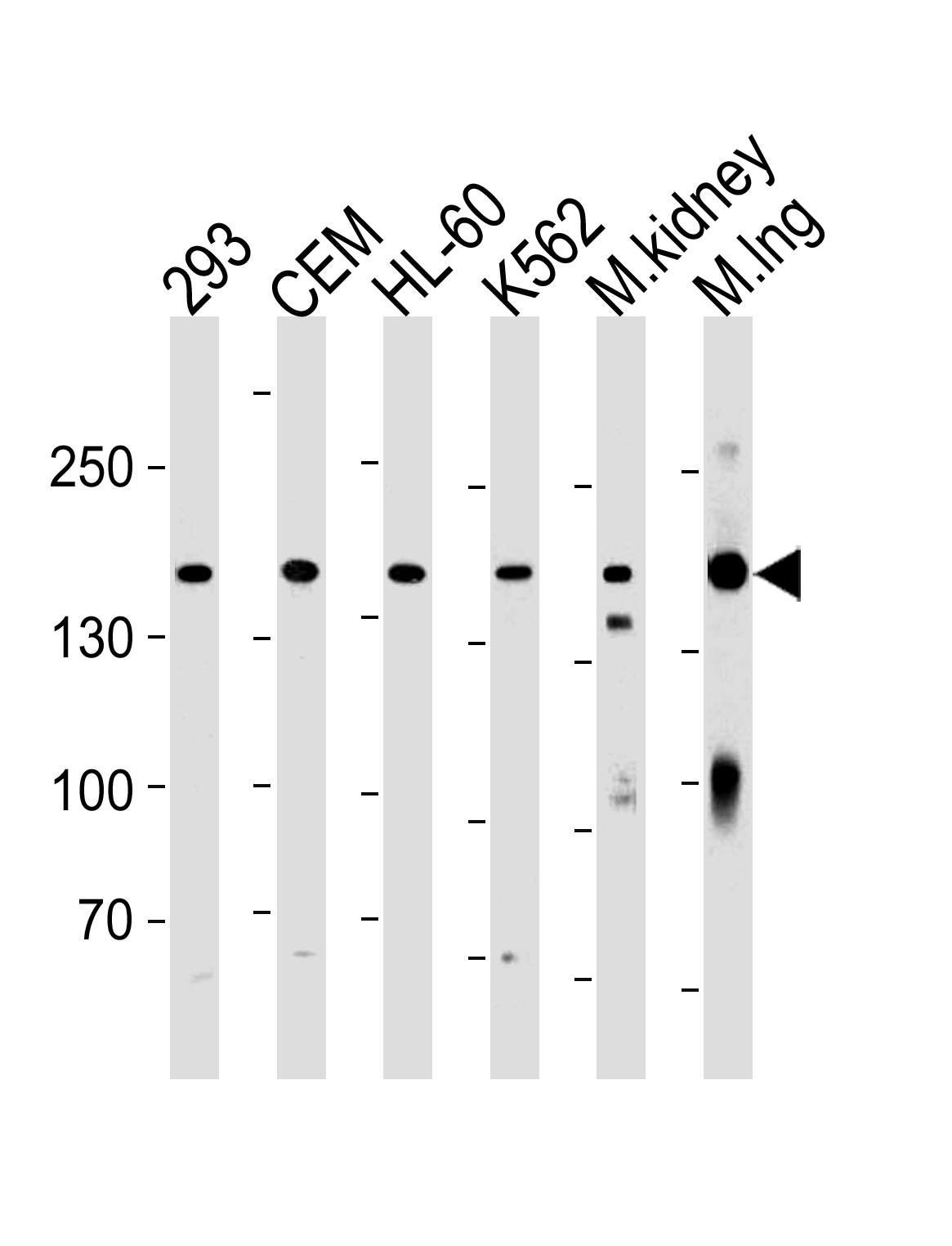 Rabbit Polyclonal Antibody to PKP4