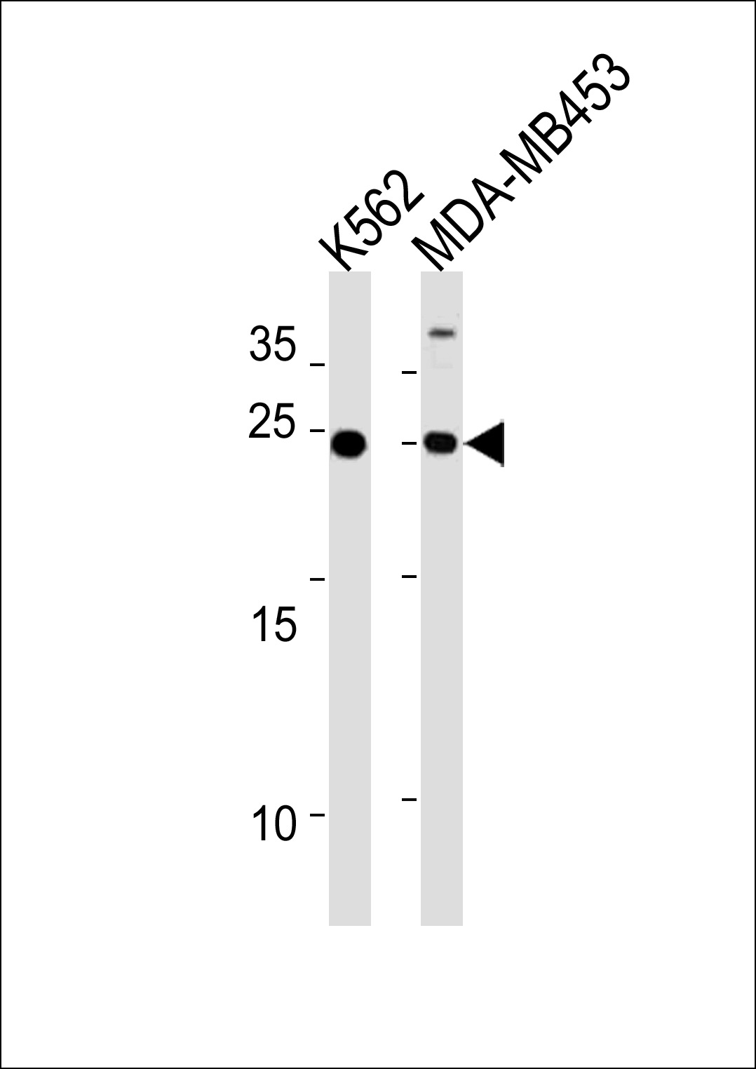 Rabbit Polyclonal Antibody to SSPN (N-term)