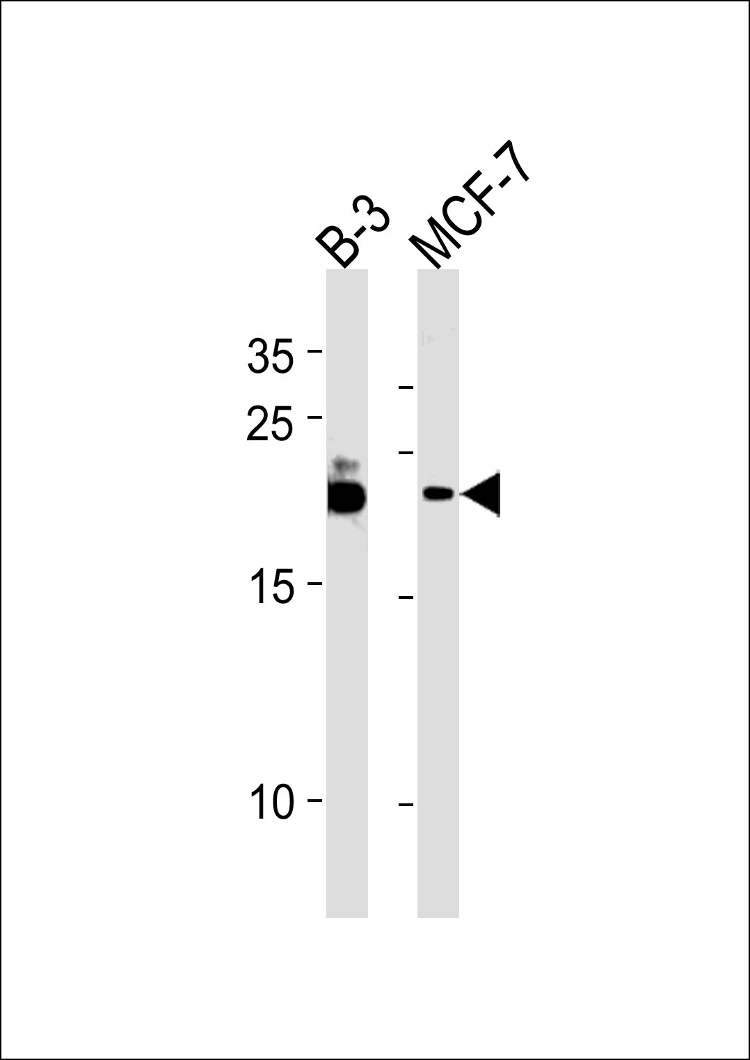 Rabbit Polyclonal Antibody to C13orf30