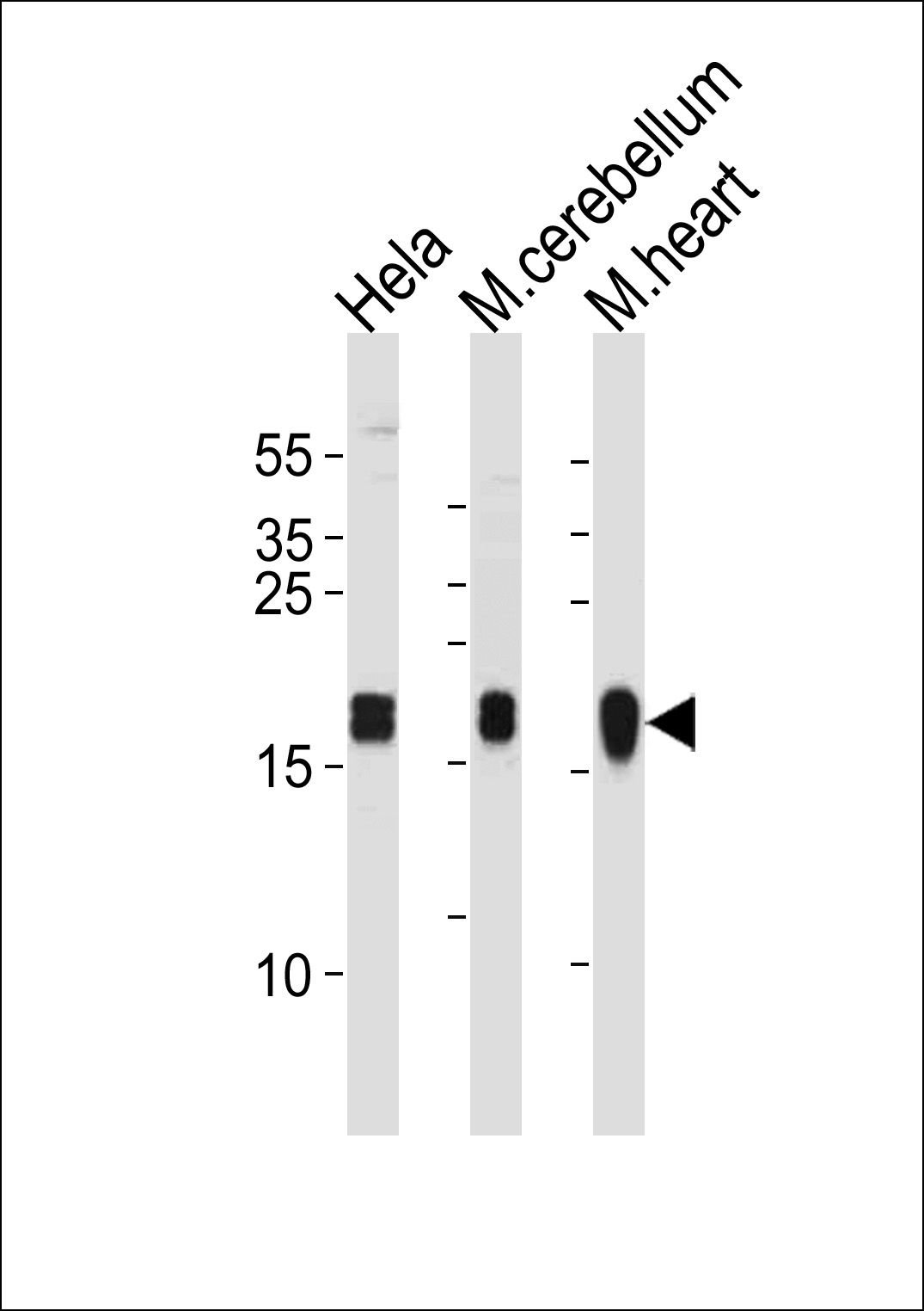 Rabbit Polyclonal Antibody to NDUFS7