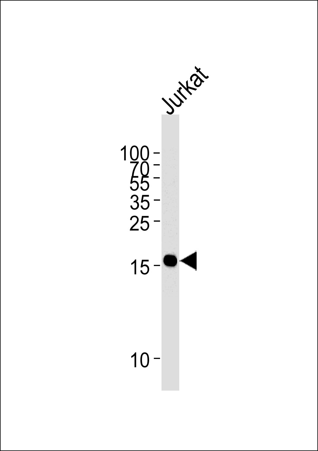 Mouse Monoclonal Antibody to GMFG(Ascites)