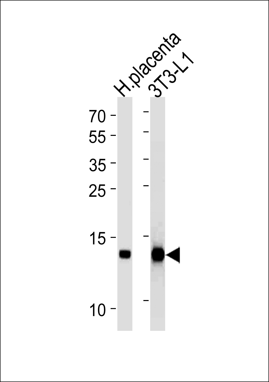 Mouse Monoclonal Antibody to FABP4