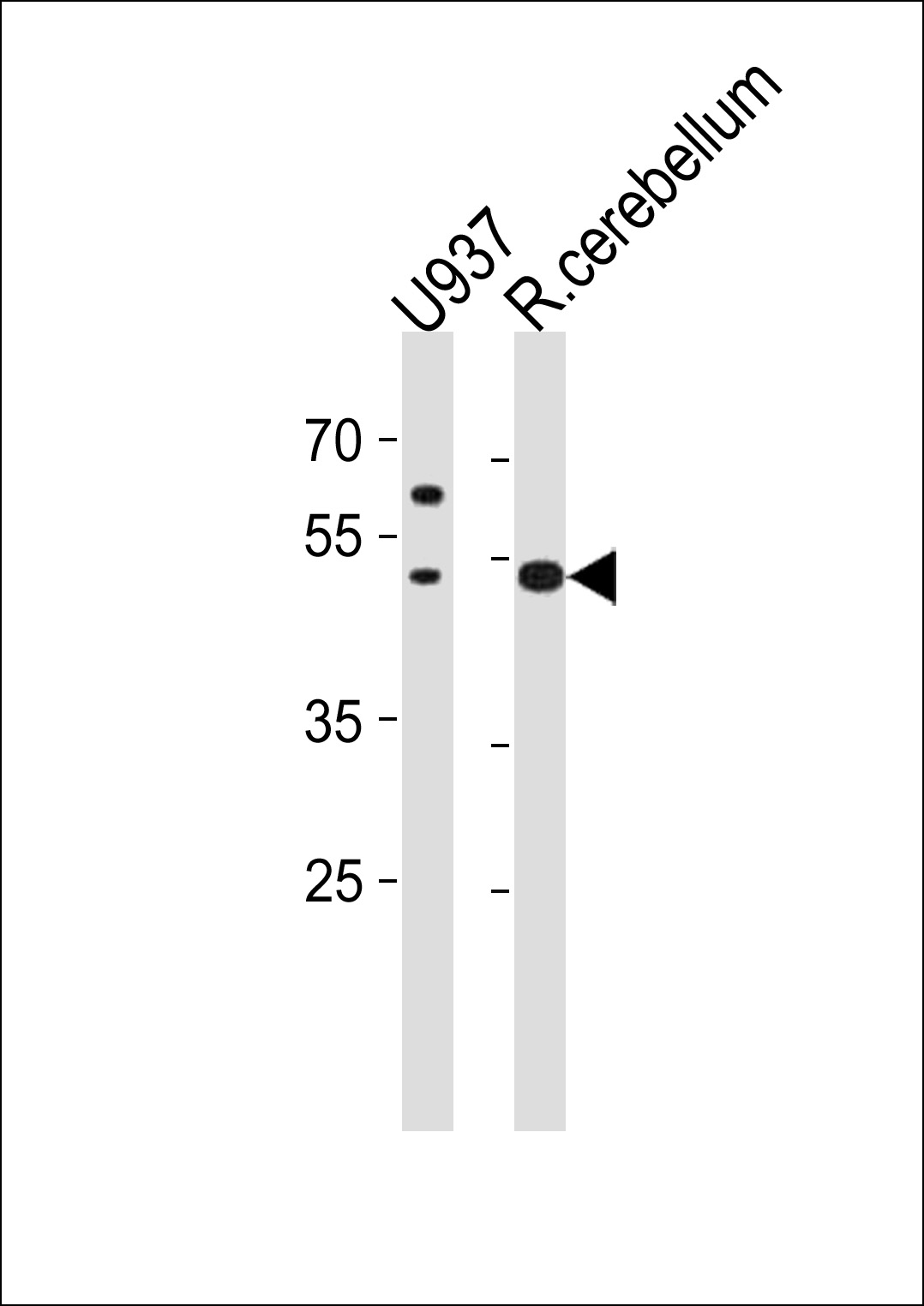 Rabbit Polyclonal Antibody to SLC25A25 (N-term)
