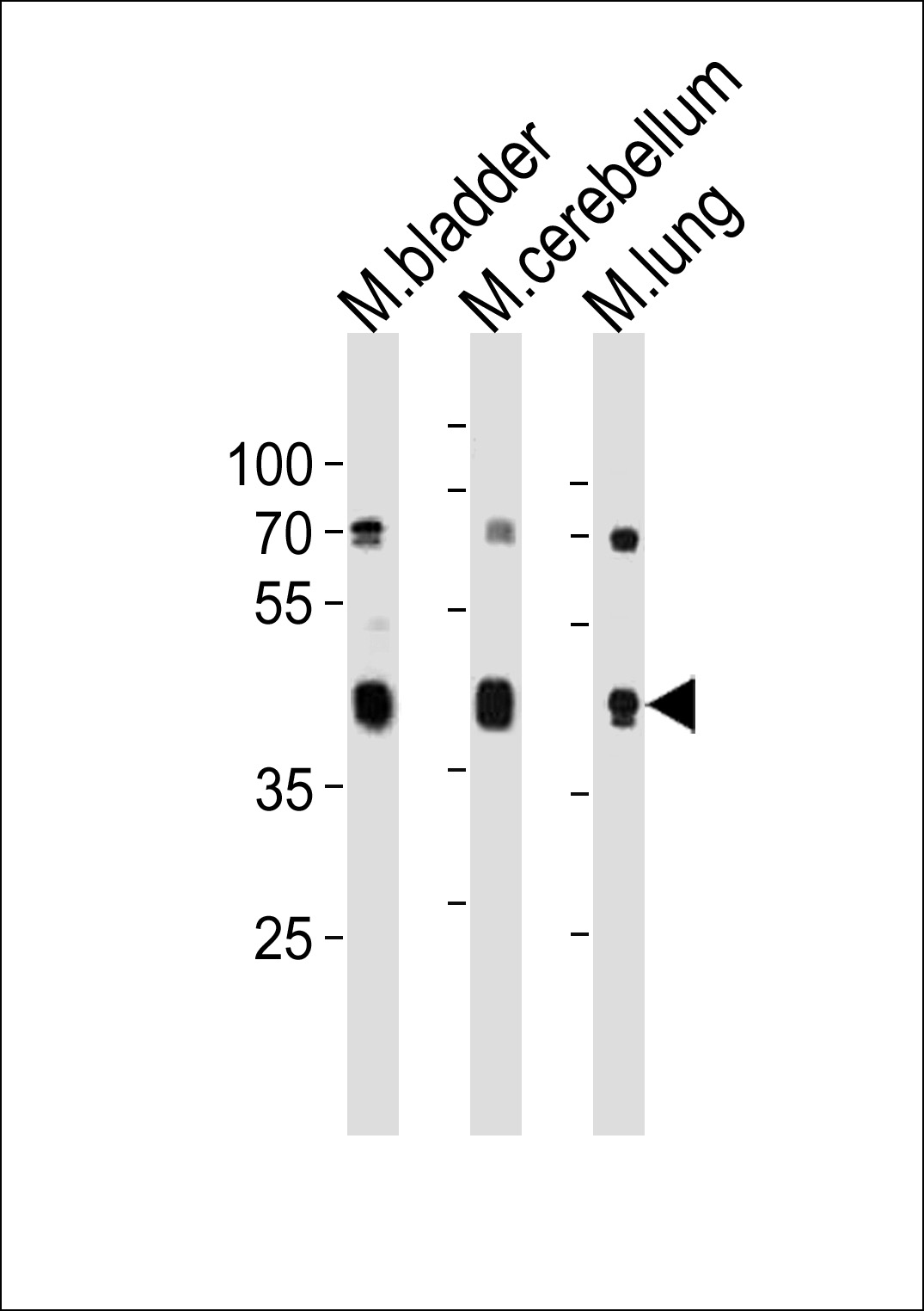 Rabbit Polyclonal Antibody to M Cckar