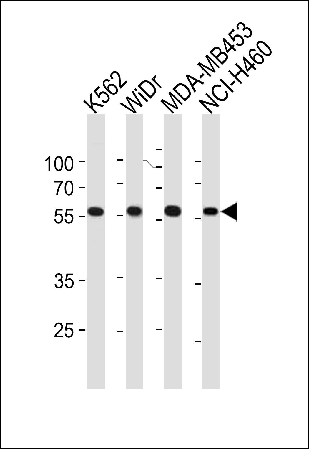 Rabbit Polyclonal Antibody to NPIPL2