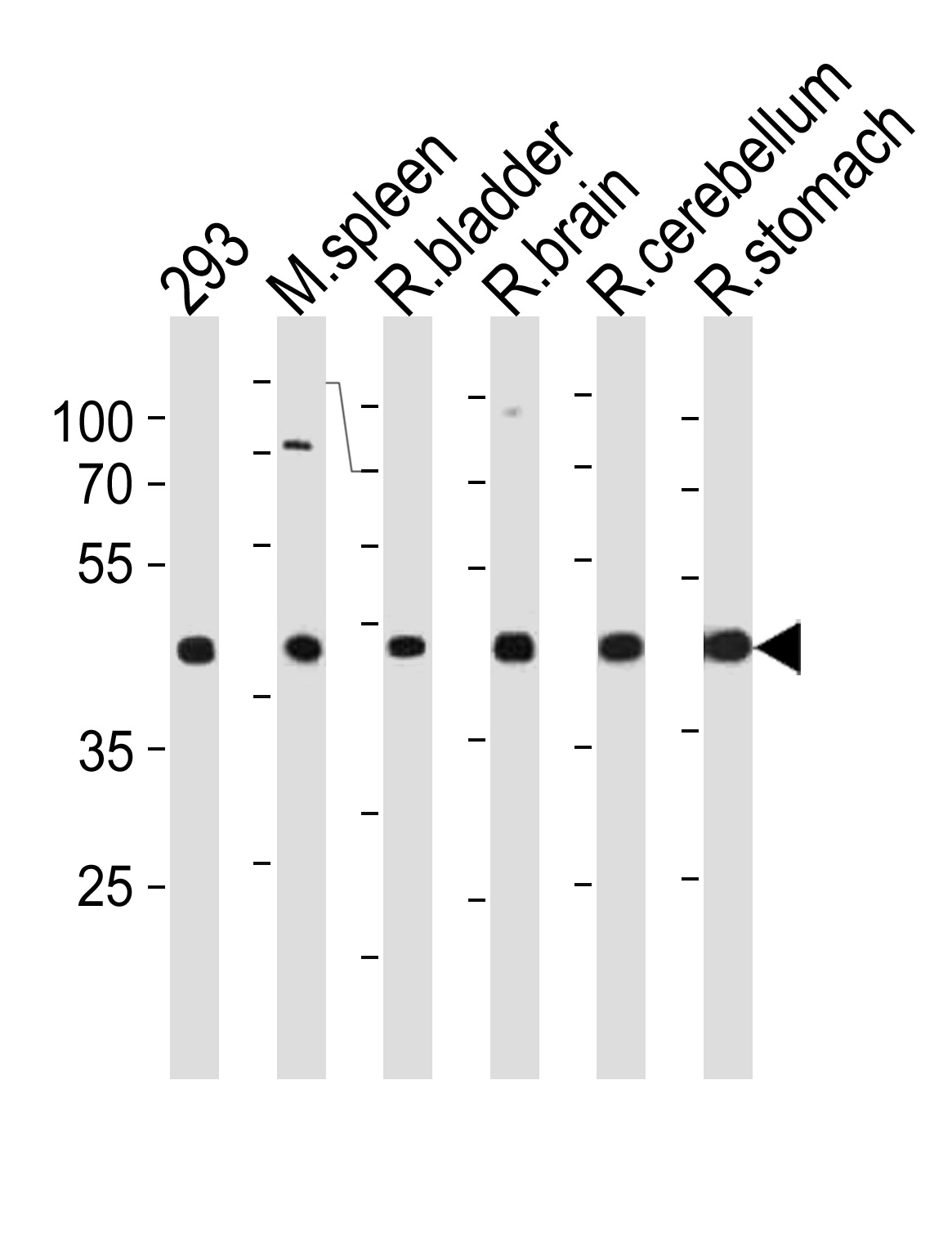 Rabbit Polyclonal Antibody to R Ccdc89